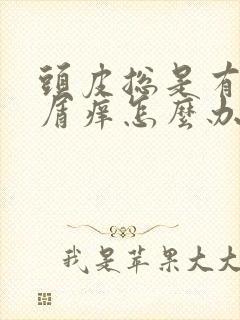 头皮总是有头皮屑痒怎么办