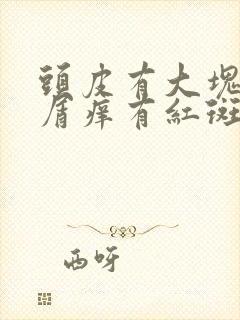 头皮有大块有皮屑痒有红斑