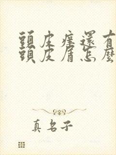 头皮痒还有很多头皮屑怎么办