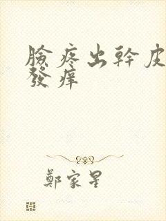 脸疼出干皮发红发痒