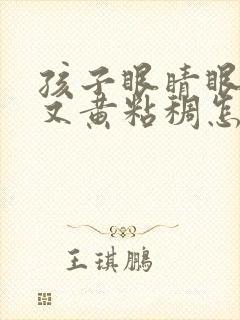 孩子眼睛眼屎多又黄粘稠怎么办封面