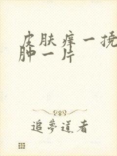 皮肤痒一挠就红肿一片