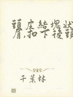 头皮结块状头皮屑,扣下后头皮红的