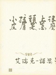 小孩头上很多头皮屑是怎么回事