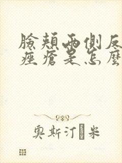 脸颊两侧反复长痤疮是怎么回事封面