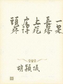 头皮上长一碰就疼得疙瘩是怎么回事