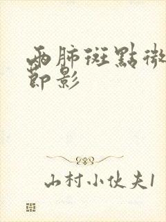 两肺斑点微小结节影封面