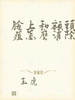 脸上和额头长痘痘怎么消除