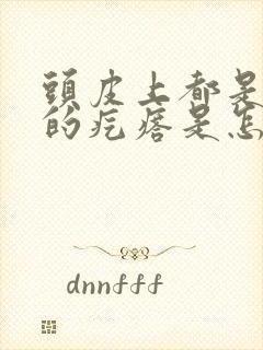 头皮上都是红色的疙瘩是怎么回事