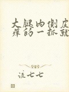 大腿内侧皮肤痒痒的一抓就更痒然后起疙瘩