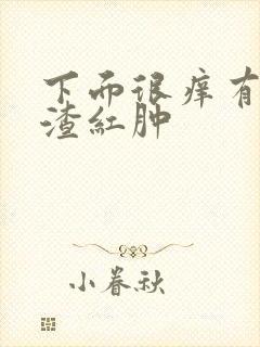 下面很痒有豆腐渣红肿