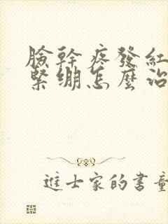 脸干疼发红刺疼紧绷怎么治疗