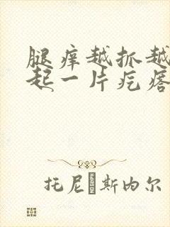 腿痒越抓越痒还起一片疙瘩