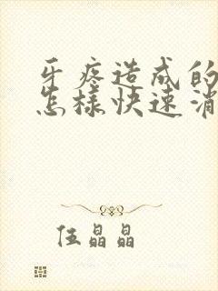 牙疼造成的脸肿怎样快速消肿封面