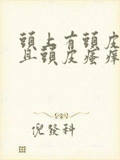 头上有头皮屑而且头皮瘙痒怎么办封面