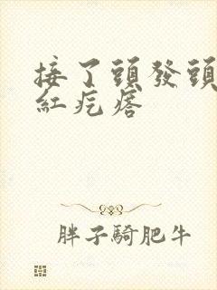 接了头发头皮起红疙瘩