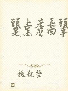 头上老长头皮屑是怎么回事