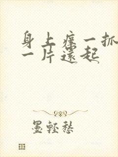 身上痒一抓就红一片还起