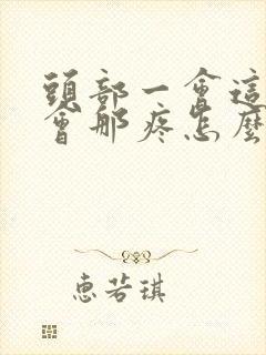 头部一会这疼一会那疼怎么回事