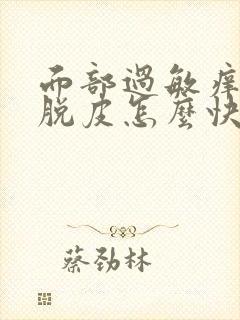 面部过敏痒红肿脱皮怎么快速解决