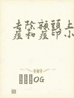 去除额头上的痘痘和痘印小妙招