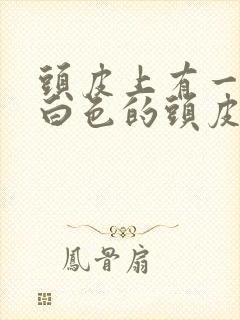 头皮上有一块块白色的头皮屑