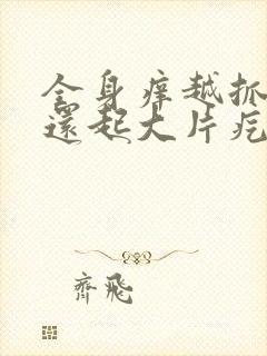 全身痒越抓越痒还起大片疙瘩