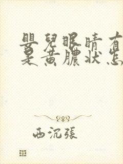 婴儿眼睛有眼屎是黄脓状怎么办