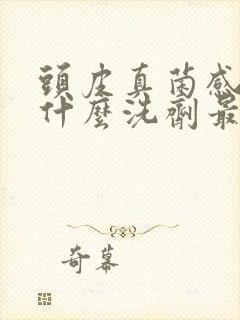 头皮真菌感染用什么洗剂最好