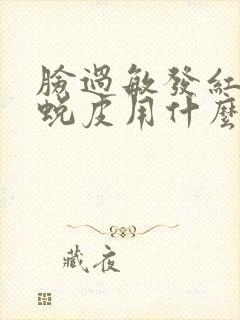 脸过敏发红发痒蜕皮用什么方法才好