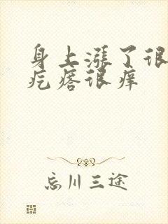 身上涨了很多红疙瘩很痒