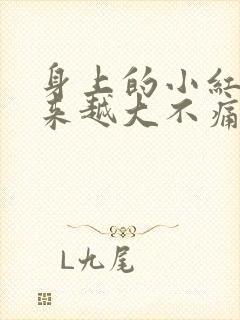 身上的小红点越来越大不痛不痒