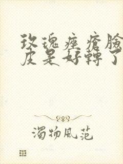 玫瑰痤疮脸上起皮是好转了吗