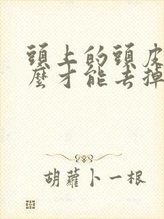 头上的头皮屑怎么才能去掉