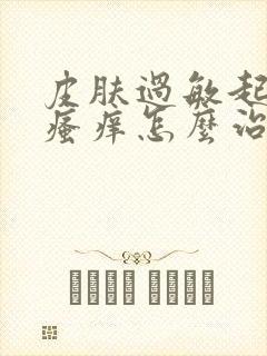 皮肤过敏起疙瘩瘙痒怎么治疗封面