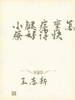 小腿痉挛怎么治疗好得快封面