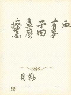 擦鼻子有血丝是怎么回事