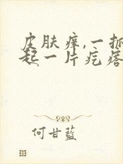 皮肤痒,一抓就起一片疙瘩什么原因