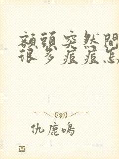 额头突然间长了很多痘痘怎么回事封面