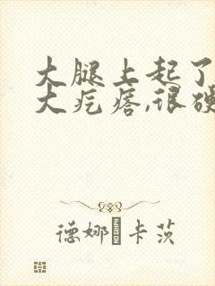 大腿上起了一个大疙瘩,很硬,一按疼