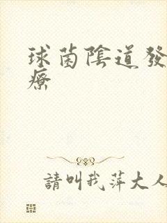 球菌阴道发炎治疗