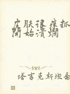 皮肤很痒抓破皮开始溃烂