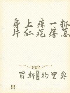 身上痒一抓一大片红疙瘩怎么办