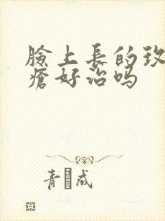 脸上长的玫瑰痤疮好治吗