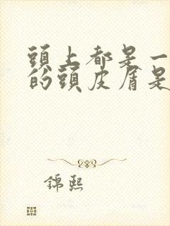 头上都是一块块的头皮屑是怎么回事