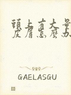 头上有大量的头皮屑怎么办封面