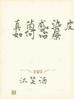 真菌感染皮肤病如何治疗