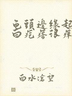 龟头边缘起一排白疙瘩很痒