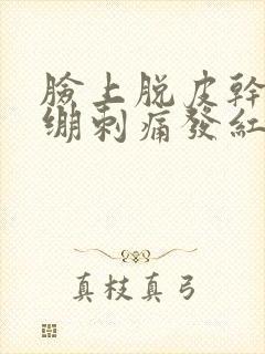 脸上脱皮干燥紧绷刺痛发红用什么药膏