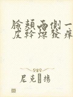 脸颊两侧一直脱皮干燥发痒发红怎么办